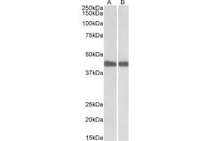 AP22441PU-N IDH1 antibody staining of Mouse (A) and Rat (B) Liver lysates at 0. (Isocitrate Dehydrogenase antibody  (Internal Region))
