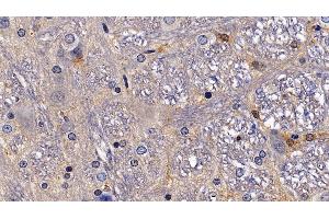 Detection of NPS in Rat Spinal cord Tissue using Polyclonal Antibody to Neuropeptide S (NPS) (NPS antibody  (AA 26-89))
