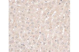 Immunohistochemistry of paraffin-embedded Rat liver using HMGN1 Polyclonal Antibody at dilution of 1:100 (40x lens).