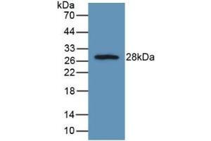 Detection of Recombinant FGFRL1, Rat using Polyclonal Antibody to Fibroblast Growth Factor Receptor Like Protein 1 (FGFRL1) (FGFRL1 antibody  (AA 164-368))