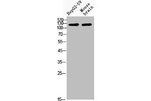 Western Blot analysis of HepG2-UVmouse brain cells using Acetyl-CRM1 (K568) Polyclonal Antibody (XPO1 antibody  (acLys568))
