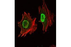 Immunofluorescence analysis of NTERA-2 cells using Oct4 mouse mAb (green). (OCT4 antibody)