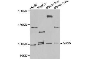 Western blot analysis of extracts of various cells, using ACAN antibody. (Aggrecan antibody)