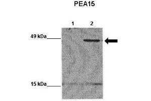 WB Suggested Anti-PEA15 Antibody    Positive Control:  Lane 1: 20ug EGFP-transfected MCF7 lysate Lane 2: 20ug EGFP-PEA15 transfected MCF7 lysate   Primary Antibody Dilution :   1:1000  Secondary Antibody :  Goat anti-rabbit-HRP   Secondry Antibody Dilution :   1:5000  Submitted by:  Yann Wallez (Sanford-Burnham Medical Research Institute) (PEA15 antibody  (Middle Region))