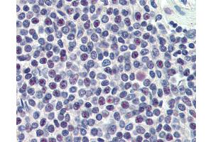 Anti-HMG20A antibody IHC of human spleen. (HMG20A antibody  (AA 336-347))