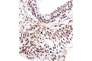 Immunohistochemistry (Paraffin-embedded Sections) (IHC (p)) image for anti-H2A Histone Family, Member X (H2AFX) (AA 115-143), (C-Term) antibody (ABIN1882250)