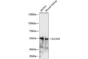 Western blot analysis of extracts of various cell lines, using SLC2 antibody (ABIN7270416) at 1:1000 dilution. (SLC2A9 antibody  (AA 400-500))