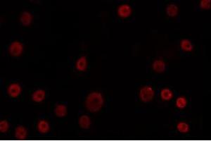 ABIN6266690 staining K562 by IF/ICC. (OVOL1 antibody  (N-Term))