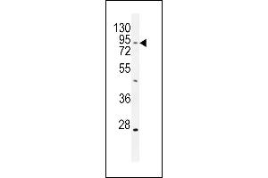 TBC1D14 antibody  (AA 259-286)