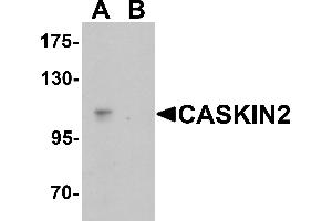 Western blot analysis of CASKIN2 in Hela cell lysate with CASKIN2 antibody at 1 µg/mL in (A) the absence and (B) the presence of blocking peptide. (CASKIN2 antibody  (N-Term))