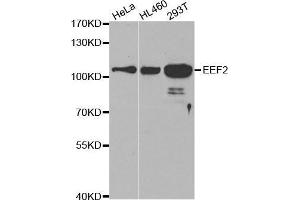Western blot analysis of extracts of various cell lines, using EEF2 antibody.