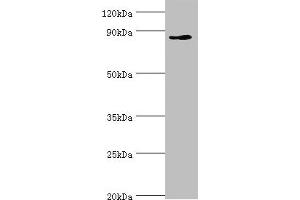 Western blot All lanes: CDH11 antibody at 6 μg/mL + Jurkat whole cell lysate Secondary Goat polyclonal to rabbit IgG at 1/10000 dilution Predicted band size: 88, 77 kDa Observed band size: 88 kDa (OB Cadherin antibody  (AA 637-796))