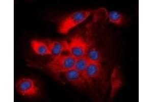 Immunofluorescent analysis of BCL2 (pT56) staining in A549 cells. (Bcl-2 antibody  (pSer56))