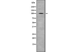 Western blot analysis of CTNNA1/CTNNA2 using HeLa whole cell lysates (CTNNA2 antibody  (C-Term))