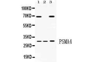 Western blot analysis of PSMA4 expression in rat liver extract ( Lane 1), mouse spleen extract ( Lane 2) and HELA whole cell lysates ( Lane 3). (PSMA4 antibody  (Middle Region))