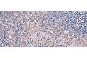 Immunohistochemistry of paraffin-embedded Human tonsil tissue using ITPR2 Polyclonal Antibody at dilution of 1:65(x200) (ITPR2 antibody)