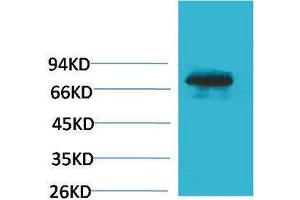 Western Blotting (WB) image for anti-Transferrin (TF) antibody (ABIN3179061) (Transferrin antibody)