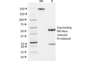 SDS-PAGE (SDS) image for anti-Premelanosome Protein (PMEL) (AA 376-502) antibody (ABIN6940589)