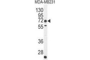 Western blot analysis in MDA-MB231 cell line lysates (35ug/lane) using C18orf8/MIC1 Antibody (N-term).