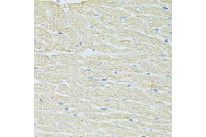 Immunohistochemistry of paraffin-embedded rat heart using SLC40A1 antibody (ABIN6292414) at dilution of 1:100 (40x lens).