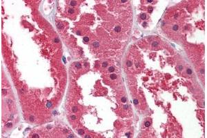 Human Kidney: Formalin-Fixed, Paraffin-Embedded (FFPE) (DDAH1 antibody  (AA 108-157))