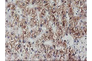 Immunohistochemical staining of paraffin-embedded Human liver tissue using anti-EXOSC7 mouse monoclonal antibody. (EXOSC7 antibody)