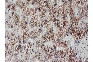 Immunohistochemical staining of paraffin-embedded Human liver tissue using anti-EXOSC7 mouse monoclonal antibody. (EXOSC7 antibody)