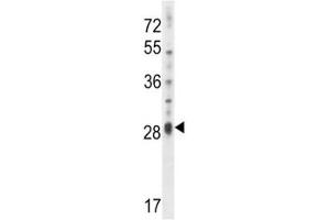 IL17D antibody western blot analysis in NCI-H460 lysate. (IL17D antibody  (AA 155-183))