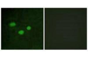 Immunofluorescence analysis of HeLa cells, using DNMT3B antibody. (DNMT3B antibody  (N-Term))