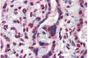 Human Placenta (formalin-fixed, paraffin-embedded) stained with ATF6 antibody ABIN337286 at 10 ug/ml followed by biotinylated anti-mouse IgG secondary antibody ABIN481714, alkaline phosphatase-streptavidin and chromogen. (ATF6 antibody  (AA 1-273))