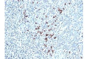 Image no. 1 for Mouse anti-Human kappa Light Chain antibody (ABIN6174069) (Mouse anti-Human kappa Light Chain Antibody)