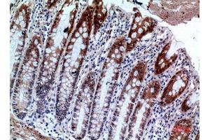 Immunohistochemistry (IHC) analysis of paraffin-embedded Human Colon, antibody was diluted at 1:100. (IL1R2 antibody  (Internal Region))