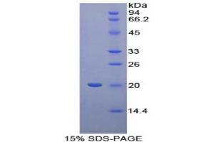 SDS-PAGE analysis of Human Cyclophilin B Protein. (PPIB Protein)