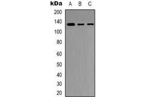 Western blot analysis of JAK2 expression in Jurkat (A), K562 (B), HEK293T (C) whole cell lysates.