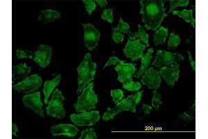 Immunofluorescence of monoclonal antibody to ROCK1 on HeLa cell. (ROCK1 antibody  (AA 401-510))