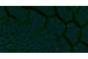 Paraformaldehyde-fixed, paraffin embedded Mouse small intestine, Antigen retrieval by boiling in sodium citrate buffer (pH6. (CD248 antibody  (AA 251-350))