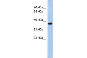WB Suggested Anti-PPAPDC2 Antibody Titration: 0. (PPAPDC2 antibody  (N-Term))