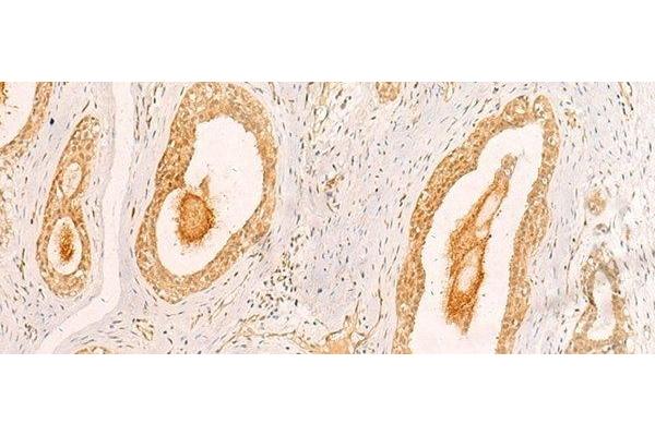 ZNF580 antibody