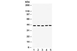 Western blot testing of 1) rat ovary, 2) rat testis, 3) mouse testis, 4) human 22RV1 and 5) human SKOV lysate with GNAQ antibody. (GNAQ antibody)