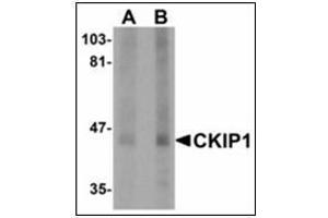 Western blot analysis of CKIP1 in human lung tissue lysate with CKIP1 antibody at (A) 1 and (B) 2 µg/ml.