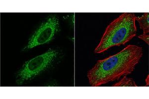 ICC/IF Image Pyruvate Dehydrogenase E1 alpha antibody detects Pyruvate Dehydrogenase E1 alpha protein at mitochondria by immunofluorescent analysis. (Pyruvate Dehydrogenase E1 alpha (Center) antibody)