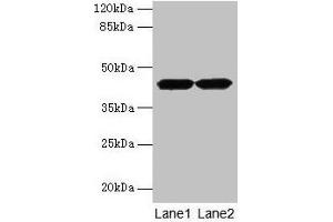 Western blot All lanes: ACTRT2 antibody at 6 μg/mL Lane 1: HepG2 whole cell lysate Lane 2: A431 whole cell lysate Secondary Goat polyclonal to rabbit IgG at 1/10000 dilution Predicted band size: 42 kDa Observed band size: 42 kDa (ACTRT2 antibody  (AA 1-376))
