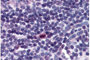 Human Tonsil (formalin-fixed, paraffin-embedded) stained with BIRC5 antibody ABIN214295 at 2. (Survivin antibody  (C-Term))