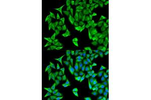 Immunofluorescence analysis of HeLa cells using PSMD9 antibody. (PSMD9 antibody  (AA 1-223))