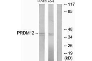 Western blot analysis of extracts from HuvEc/A549 cells, using PRDM12 Antibody. (PRDM12 antibody  (AA 191-240))