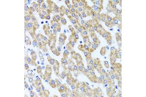 Immunohistochemistry of paraffin-embedded human liver injury using INADL antibody. (PATJ antibody)