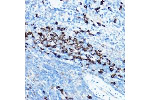 Immunohistochemistry (IHC) image for anti-Heat Shock Protein 90kDa beta (Grp94), Member 1 (HSP90B1) (AA 550-650) antibody (ABIN6142031)