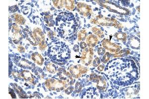 P2RX7 antibody was used for immunohistochemistry at a concentration of 4-8 ug/ml to stain Epithelial cells of renal tubule (arrows) in Human Kidney. (P2RX7 antibody  (N-Term))