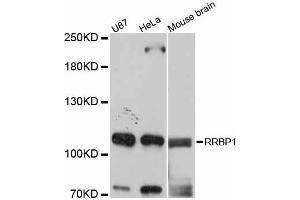 Western blot analysis of extracts of various cell lines, using RRBP1 antibody (ABIN6293720) at 1:3000 dilution. (RRBP1 antibody)