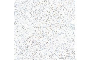 Immunohistochemistry (IHC) image for anti-Zinc Finger E-Box Binding Homeobox 1 (ZEB1) (AA 750-800) antibody (ABIN7455173)